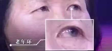 面相和健康有什么关系?分享2种方法,自测心脏和血管健康 面相和健康有什么关系?分享2种方法,自测心脏和血管健康